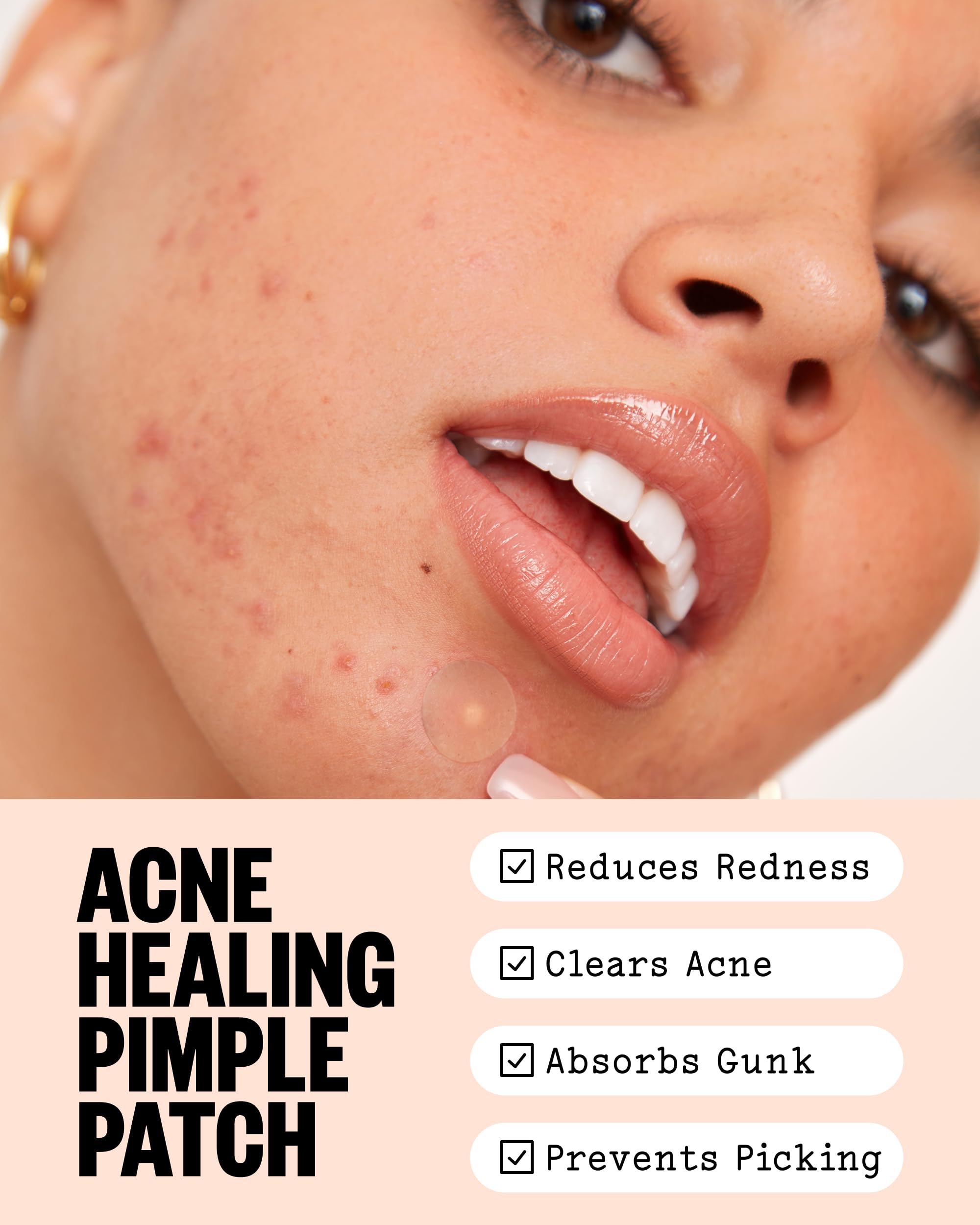 PEACE OUT Acne Healing Dots Hydrocolloid Pimple Patches (40 count)