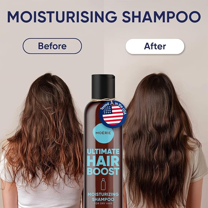 Moerie Hair Growth Shampoo for Men and Women, Hair Loss Solution with Biotin and Rosemary, Moisturizing Shampoo for Thinning Hair – Ultimate Boost for All Hair Types, Triple Set