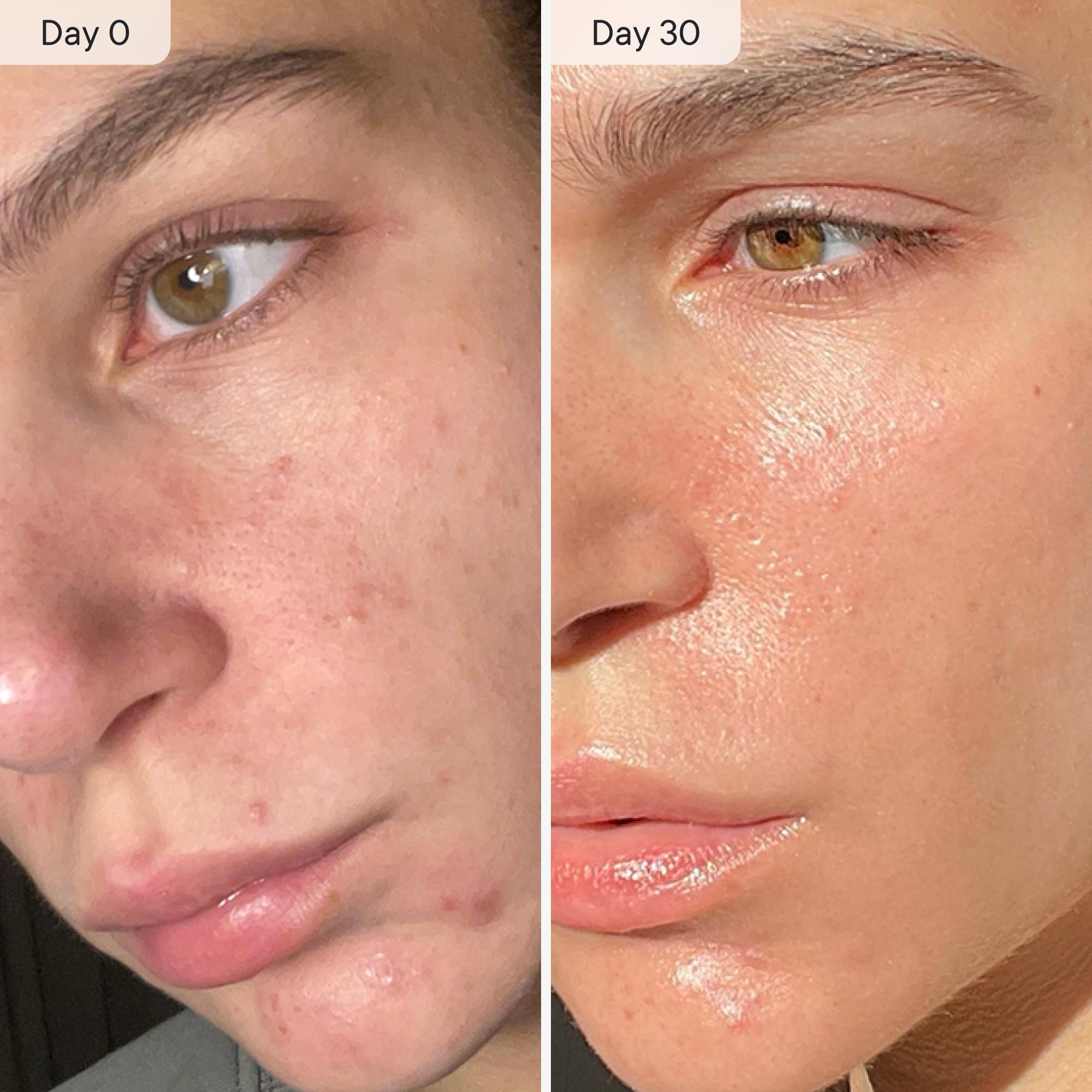 Qure Micro Infusion System for Face & Neck - Facial Moisturizing Essence, Hydrating Serum for All Skin Types, Refreshed Skin - 3-Month Supply