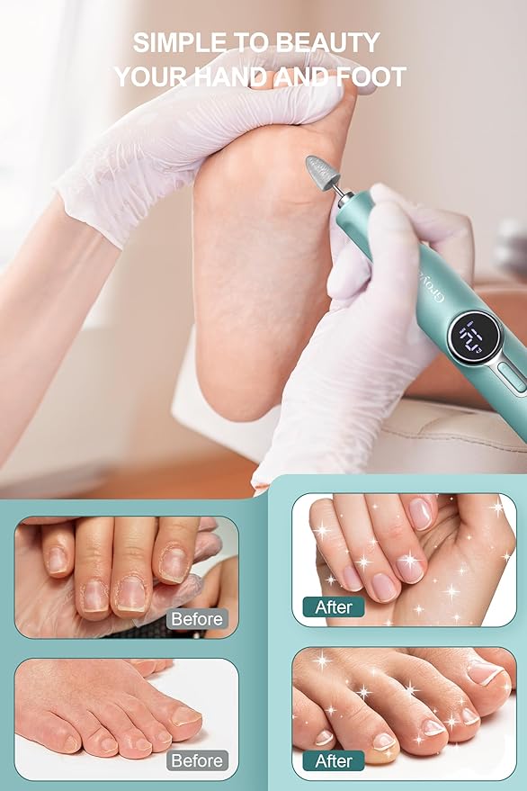 Electric Foot Callus Remover for Feet Scrubber Dead Skin, Cordless Foot File, Professional Pedicure Tool with Nail Drill Kits for Men Women Dead Dry Crack Skin Calluses Foot Grinder