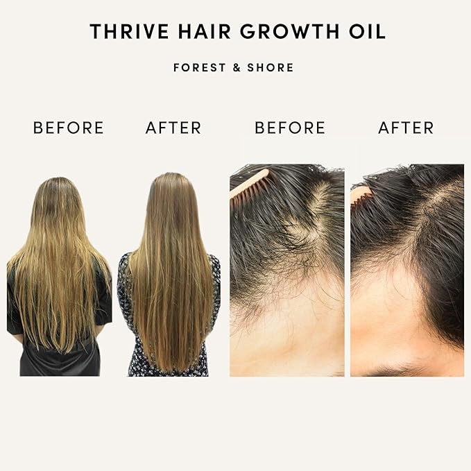 Forest & Shore Hair Growth Oil, 100% Natural, with Caffeine, Biotin, Castor, Argan & Rosemary, Effective Serum for Damaged Hair