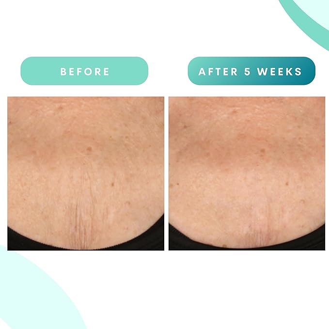 Serious Skincare, Glycolic Firming Retexturizing Body Cream with BODY FIT™, Moisturizing Lotion for Dry Skin, for Loose Crepey Skin Arms, Legs, Belly, Gentle Exfoliation for Smooth & Glowing Skin 8 Oz