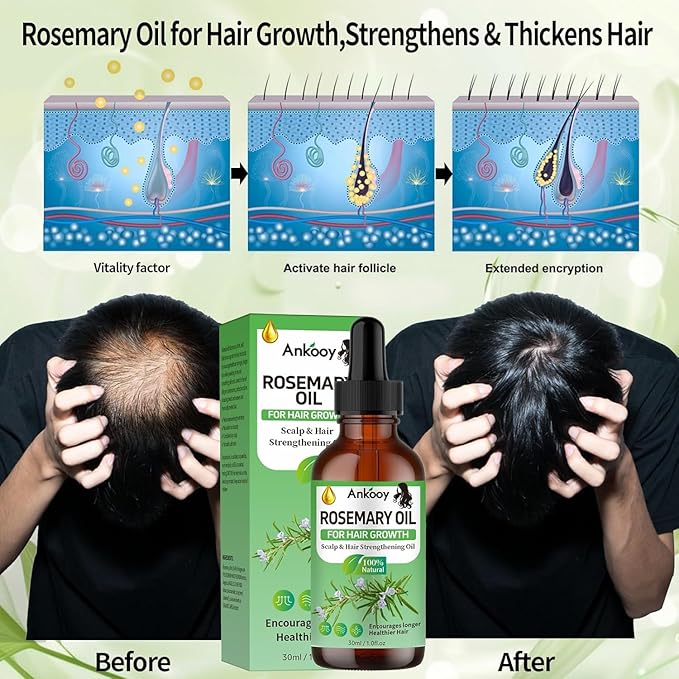 Batana Oil for Hair Growth & Rosemary Oil for Hair Growth,Raw Batana Hair Mask Rosemary Hair Growth Serum,Hair Oil for Dry Damaged Hair,Promotes Hair Thickness for Men Women