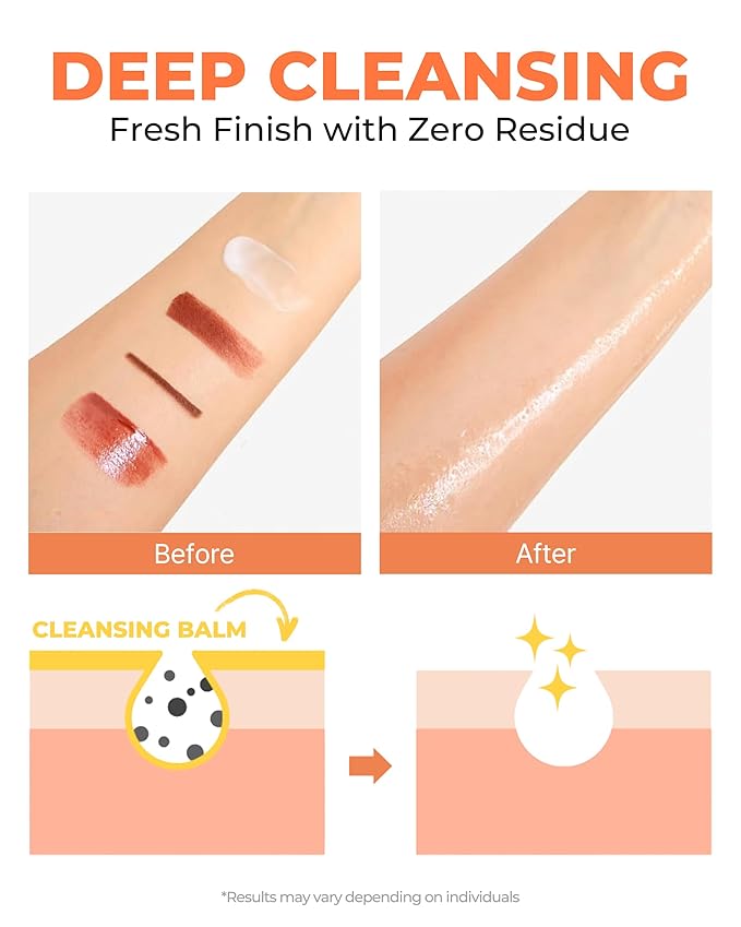 FIT YOUR SKIN Yuja Sherbet Cleansing Balm - Korean First Cleanse Makeup & Sunscreen Remover | Vitamin C Yuzu + Heartleaf | Balm to Oil Pore Care | Fresh Citrus Scent | 3.04 fl oz