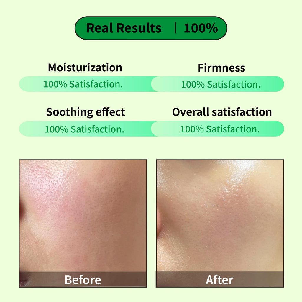 EARTHAT Barrier Repair Cream, Redness Relief for Sensitive Skin