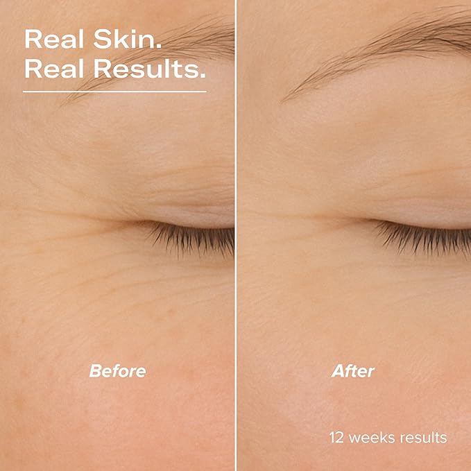 Serum Junkie Smooth Retinol and Peptide Serum with Encapsulated Retinol, Bakuchiol, Matrixyl 3000, Melatonin and Vitamin E, Targets Fine Lines, Uneven Texture, Dullness, 1 fl oz
