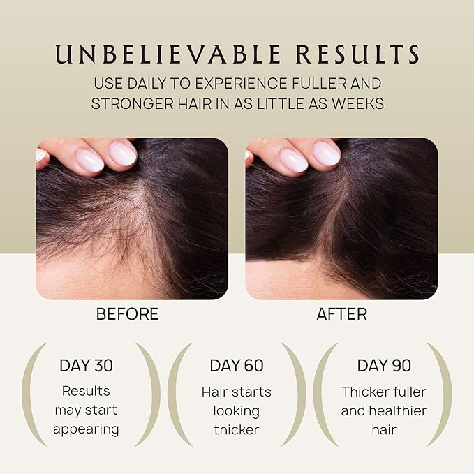 Lebanta Hair Oil Spray - 100% Pure Ingredients For Non Greasy, Thicker & Stronger Looking Hair - Organic Batana, Castor, Biotin, Saw Palmetto, and Rosemary Oil for Men & Women Scalp - 4 FL OZ