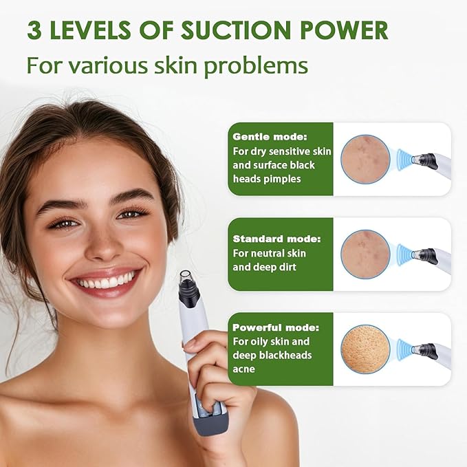 Blackhead Remover Pore Vacuum - Facial Pore Cleaner with 3 Adjustable Suction Levels, 4 Blackhead Removal Tools, Electric Acne Extractor Tool for Women & Men