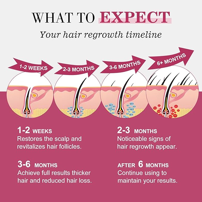 5% Minoxidil for Women Hair Regrowth Spray, hers hair regrowth treatment Infused