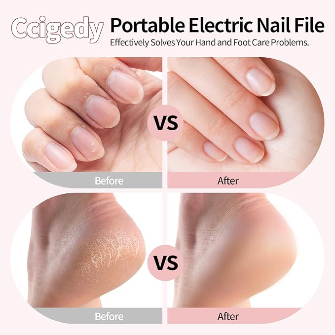 Ccigedy Cordless Electric Toe Nail Grinder for Thick Toenails with LCD Lamp