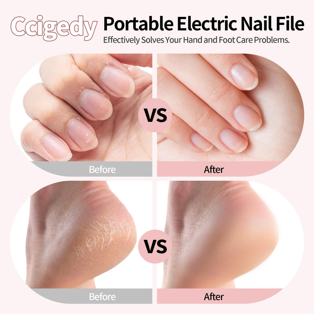 Ccigedy Cordless Electric Toe Nail Grinder for Thick Toenails with LCD Lamp