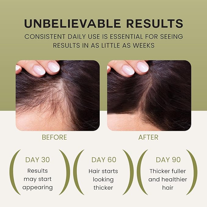 Lebanta Batana Oil For Hair - 100% Pure, Raw & Natural Blend With Organic Castor, Pumpkin Seed, Coconut and Rosemary Oil - Thicker, Stronger Looking Hair For Men & Women Scalp - 4 FL OZ