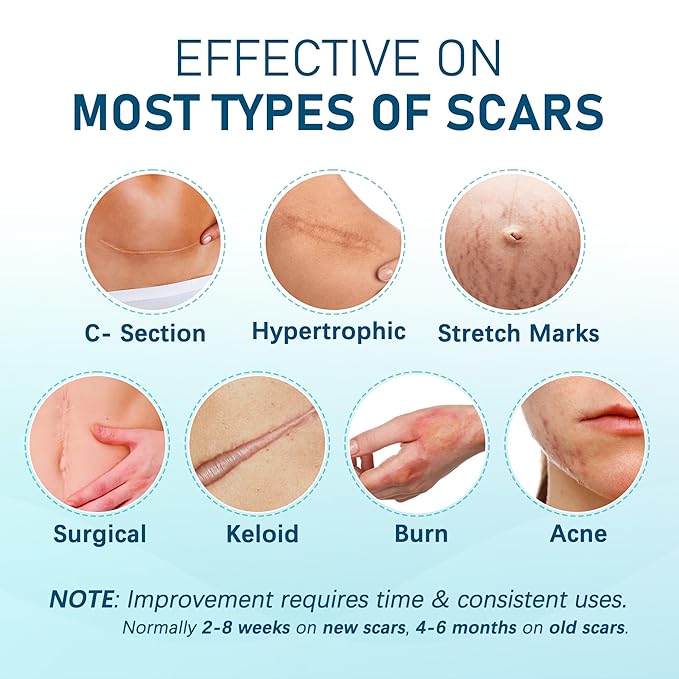 MEDLOT Silicone Scar Sheets, 10pcs, Silicone Tape for Scar Treatment, Reusable Scar Strips for Surgical, C-Section, Keloid Bump, Stretch Marks, Burn, Acne Scar Removal, Each 1.5” x 6”