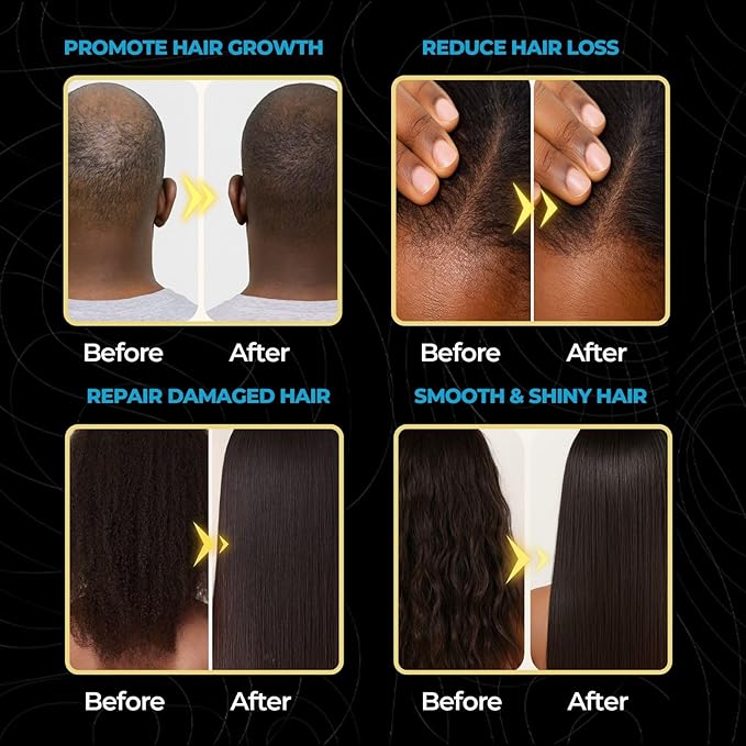 Anume Naturals 100% Pure Raw Batana Oil for Hair Growth – Organic & Unrefined Hair Oil for Dry, Frizzy & Curly Hair | Vitamin E-Rich Scalp & Hair Moisturizer | 4 oz