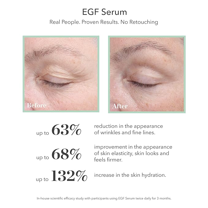BIOEFFECT EGF Serum with Growth Factor | Firming, Age Defying Face Serum