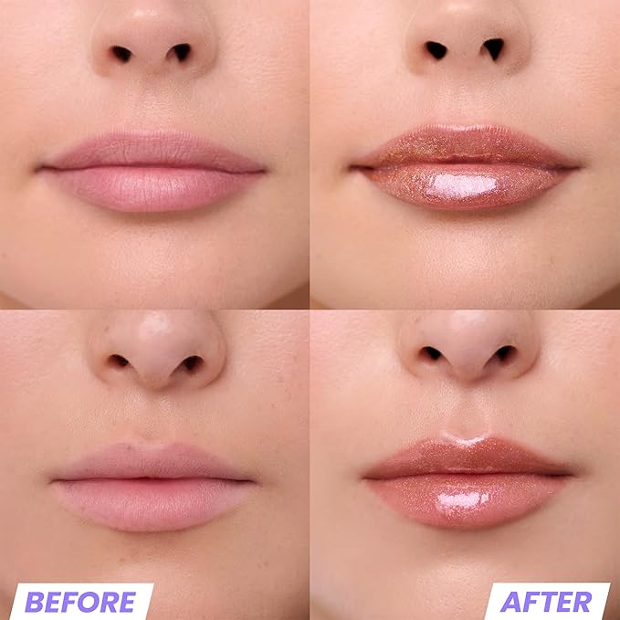 Wonderskin Lip Gloss – Wonder Blading Top Gloss, Hydrating High Shine Lip Makeup (Gold Glitter)