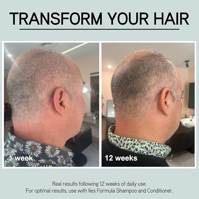 Iles Formula Grey Delay Booster, Prevents Premature Greying, 1-Month Supply
