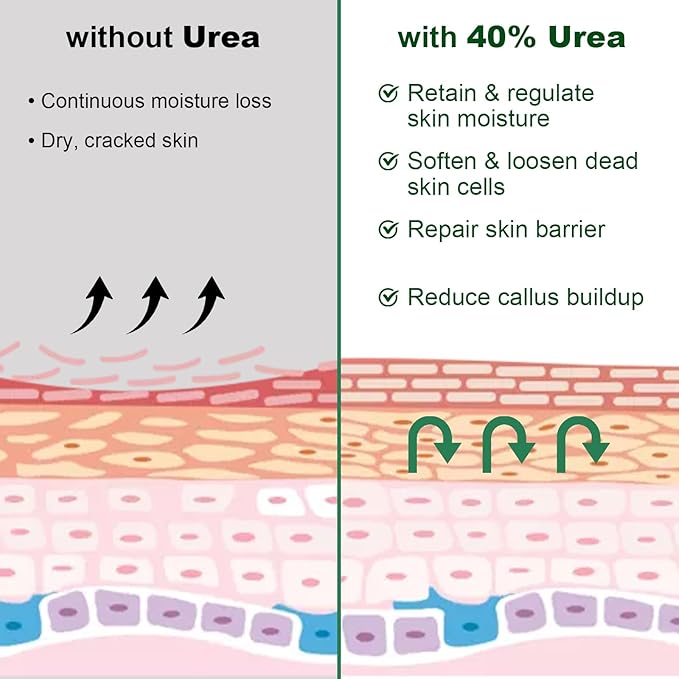 LEBARED Urea Cream 40 Percent For Feet Maximum Strength, Plus 2% Salicylic Acid with Hyaluronic Acid, Urea Foot & Hand Cream for Dry Cracked, 4.6 oz