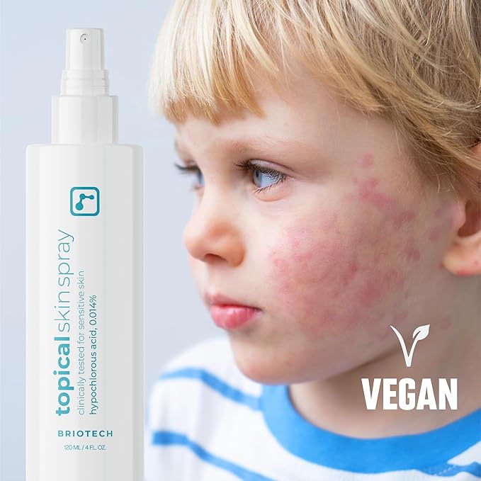BRIOTECH Topical Skin Spray, Hypochlorous Acid Spray for Sensitive Skin, HOCl Facial Mist, Full Body Support Against Irritation, Calm Redness, Soothe Foot & Scalp, 8.5 oz (1 Pack)