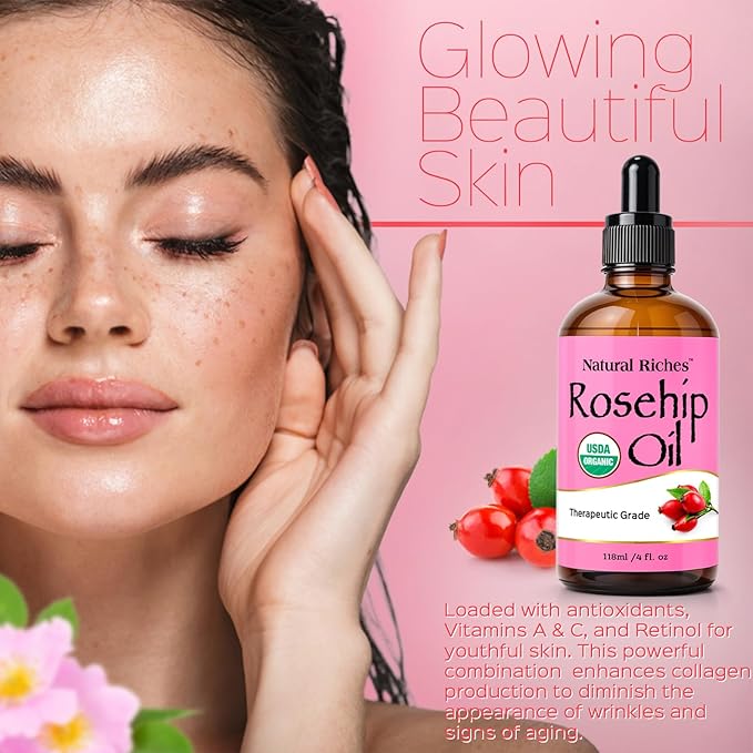 Natural Riches Rosehip Seed Oil 4 Fl Oz for Face, Skin, Hair & Nails