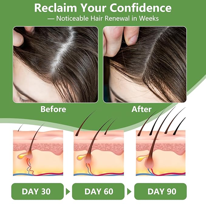 Raw Batana Oil for Hair Growth, 100% Natural Pure Batana Organic for Prevent Hair Loss, Enhances Thickness for Men & Women, Wild Growth Hair Oil, Scalp Treatment Promotes Hair Thickness 120ML