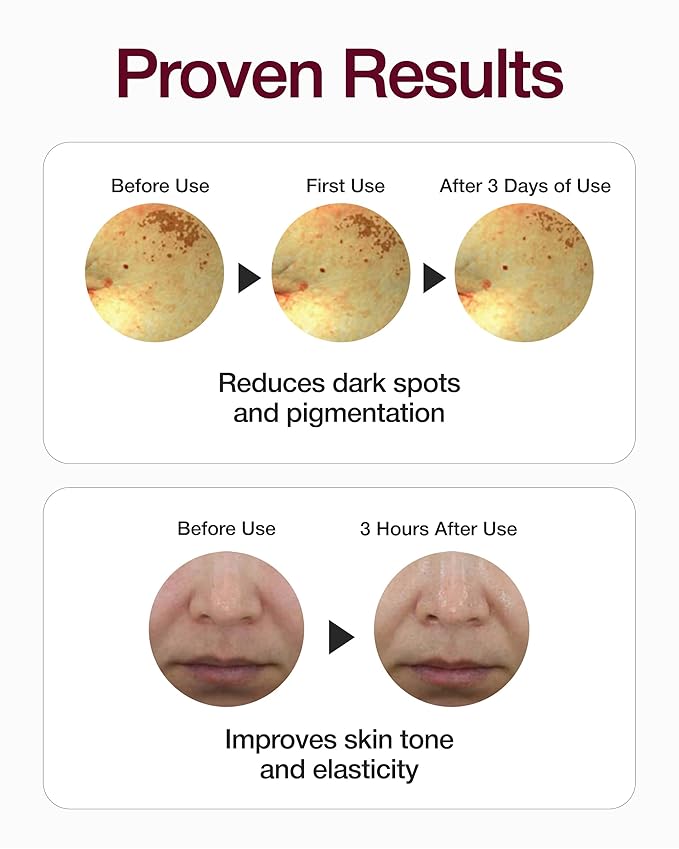 CENTELLIAN 24 Madeca Mela Capture Ampoule Max - Toning Serum