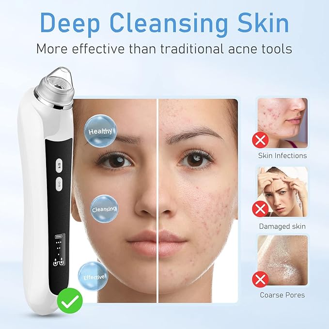 Pore Blackhead Remover