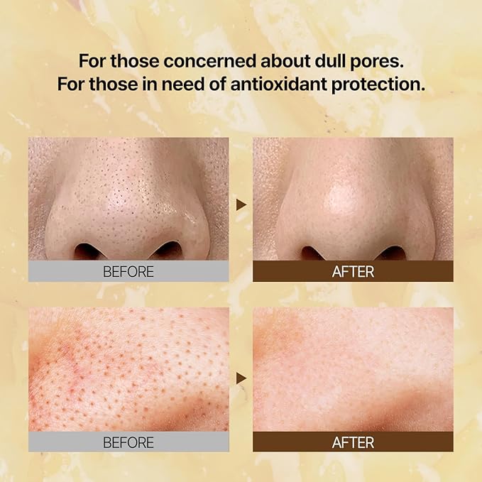 PONGDANG Real Effect Vita Toning Serum (1.01fl.oz) | Brightening Uneven Skin Tone, Refined Pores | Daily Blackheads, Pore Care with White Truffle & Niacinamide | Korean Skin Care