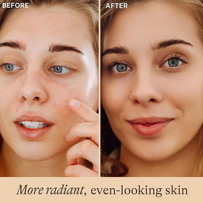 Vitamin C Face Serum - USA Made with Natural & Organic Ingredients