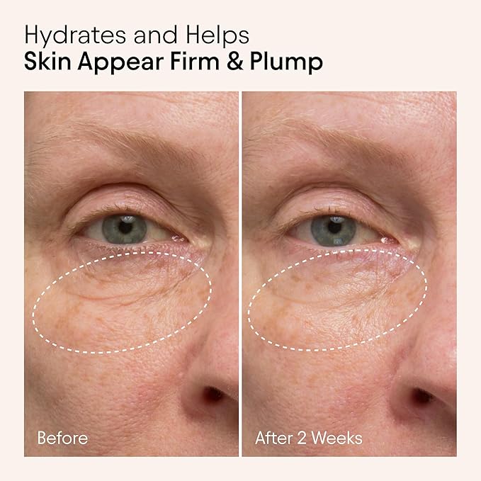 ALPYN Hydrating Firming Serum with Nettle & Niacinamide | Visibly Smooth, Plump & Firm | Reduce the Look of Fine Lines & Pores | 1 oz / 30 ml