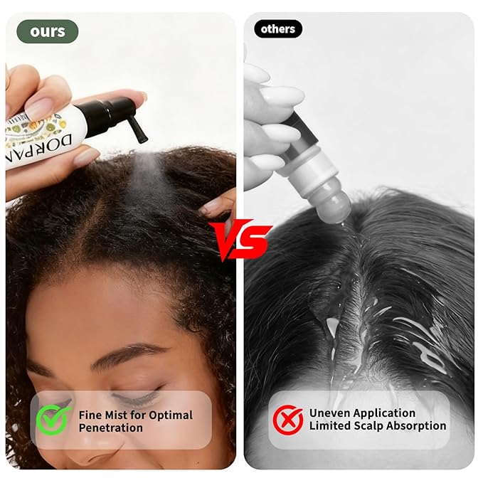 DORPANG Scalp Serum for Thinning Hair, Clinically Tested Vegan Formula with Capixyl and AnaGain, Promotes Fuller-Looking Hair & Healthy Scalp, Peptide Non-Greasy for Dry Sensitive Scalps 60ml