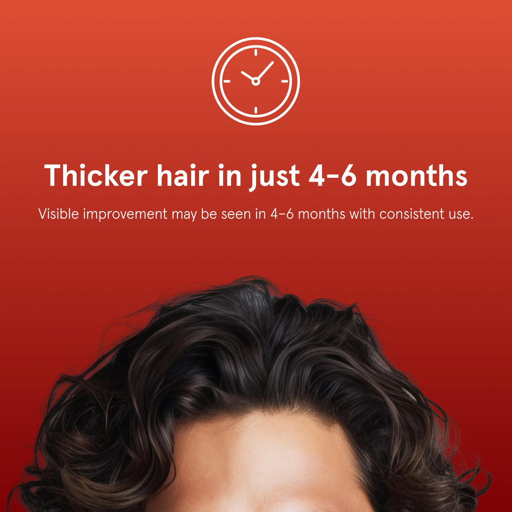 Keeps Minoxidil Solution 5% for Men, 3 Month Supply (3 x 2 fl oz Bottles)
