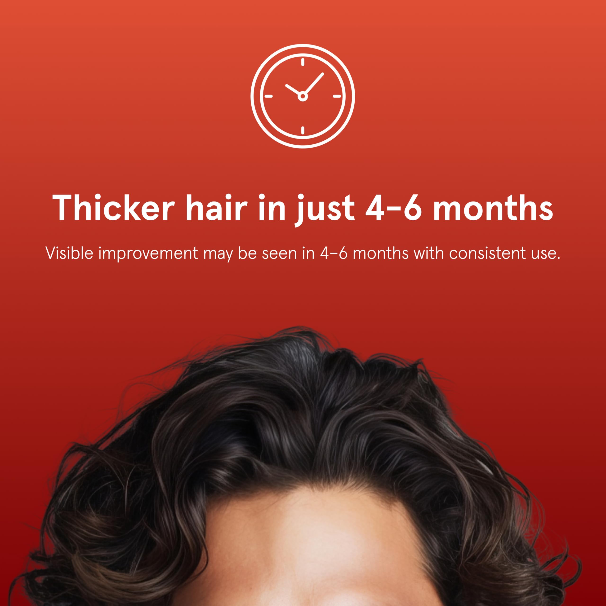 Keeps Minoxidil Solution 5% for Men, 3 Month Supply (3 x 2 fl oz Bottles)