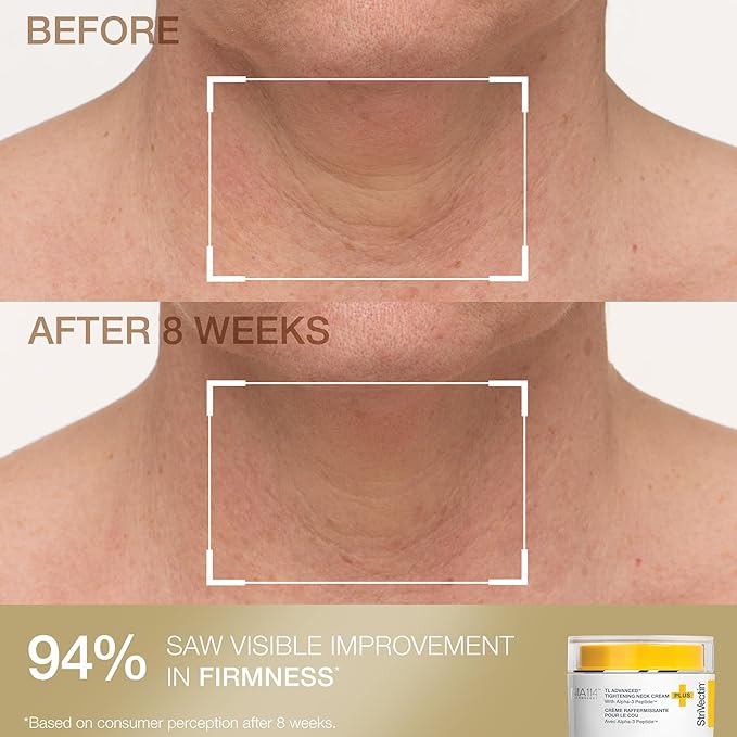 StriVectin Tighten & Smooth Neck Cream & Neck Serum Roller 2-Piece Set