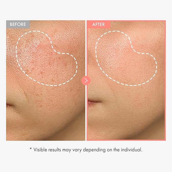 TOSOWOONG Peach 80 Niacin Serum for Dark Spots & Pores, Glass Skin, Glow