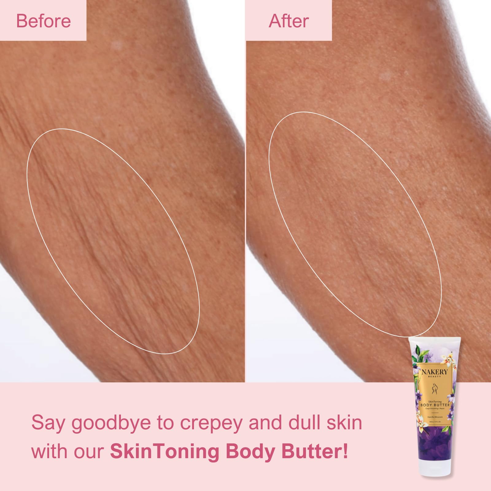 Nakery Skin Toning Body Butter for Women - Firming Body Lotion for Women - Peptide Infused Body Lotion for Crepey & Sagging Skin - Firming Lotion for Neck, Arms & Legs - Vanilla Blossoms