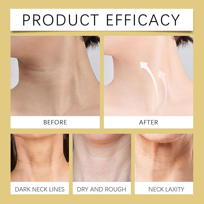 Nascence AH-8 Neck and Eye Cream Set with Electric Massage Tightening, Anti-Wrinkle Treatment with Red Light, Deep Moisturizer Bundle Care (neck cream)