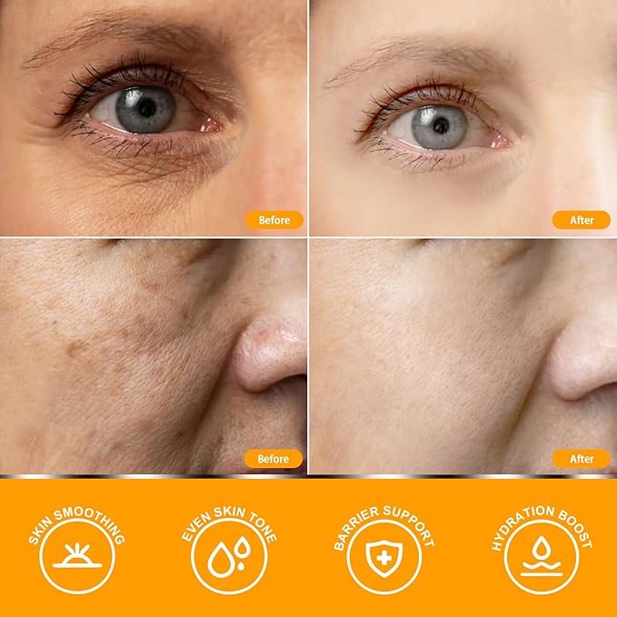Anroha Super Vitamin C Face Serum for Women Over 70, Large Size 1.7 fl oz (50ml) - Fragrance-Free Multi-Tasking Age Defying Hydrating Complex for Mature Sensitive Skin