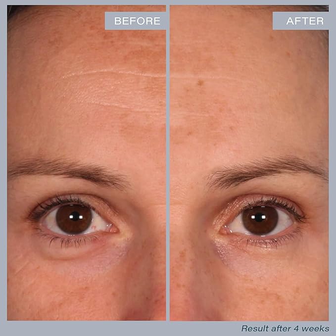 SKINN Multi-Acid Resurfacing Pads with AHA BHA - 60 Pads