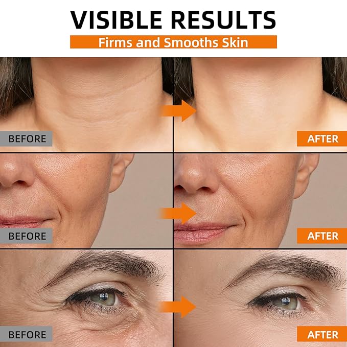 Vitamin C Retinol Serum for Face