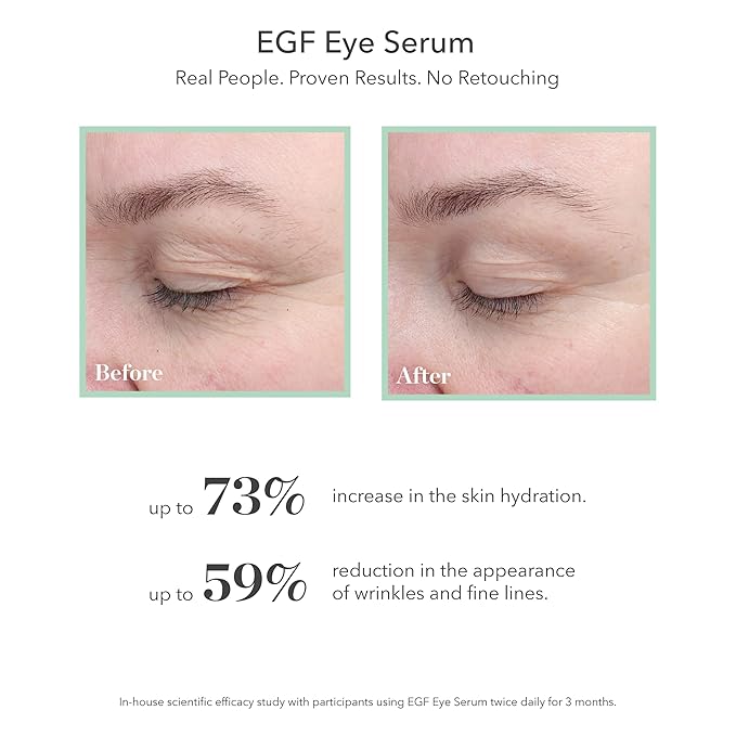 BIOEFFECT EGF Eye Serum with De-Puffer Rollerball | Age Defying, 0.20 Fl Oz