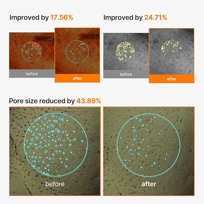 celimax Pore+Dark Spot Cream Mask 4EA