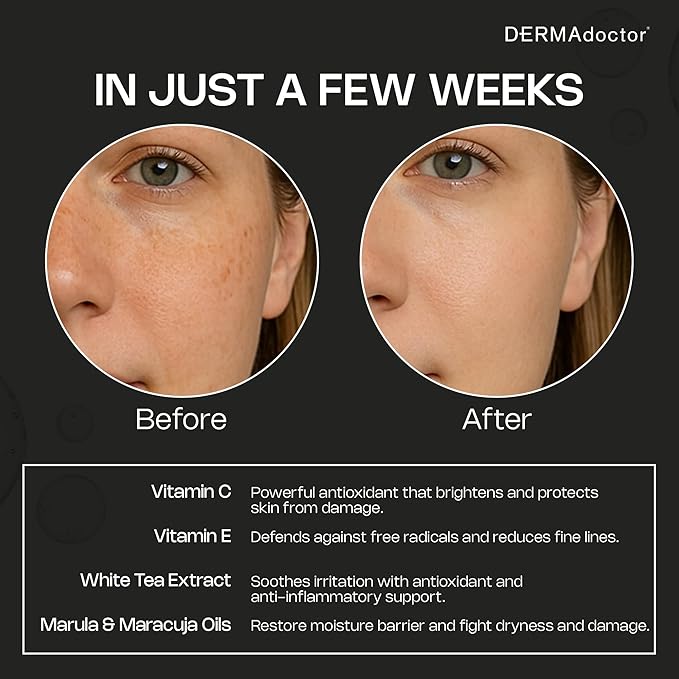 DERMAdoctor Vitamin C Oil for Face, Hydrating 20% Vitamin C Night Oil, 1 Oz