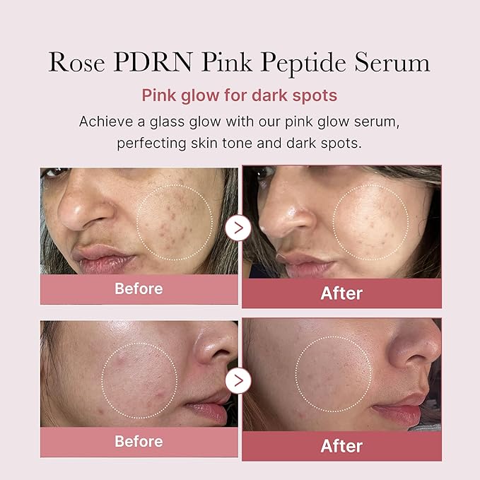 medicube PDRN Pink Peptide Serum with Rose PDRN | Vegan Pink Glow Serum with Peptides & Niacinamide for Hydration & Firm-Looking Skin | Uneven Tone Care | Korean Skincare, 1.01 fl. Oz