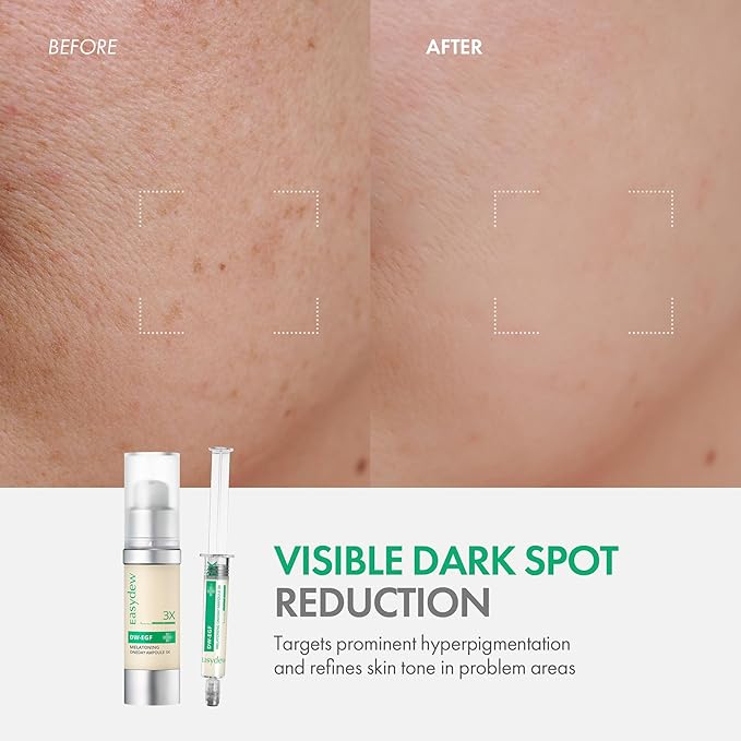 Easydew DW-EGF Melatoning Ampoule 3X - Dark Spot Serum (Bottle 1.01 fl oz)