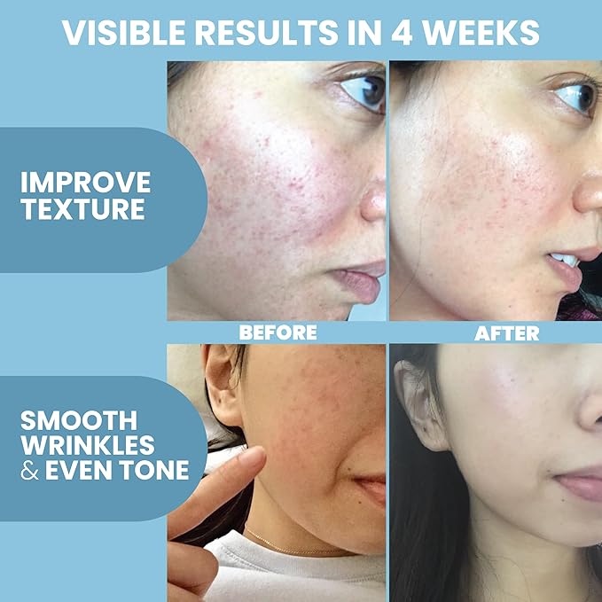 Eva Naturals Multi Peptide Face Serum – Anti Aging Collagen Peptides for Plump & Firm Skin Elasticity, Wrinkle & Fine Line Renewal, Fragrance Free Firming Facial Skincare - 1 oz