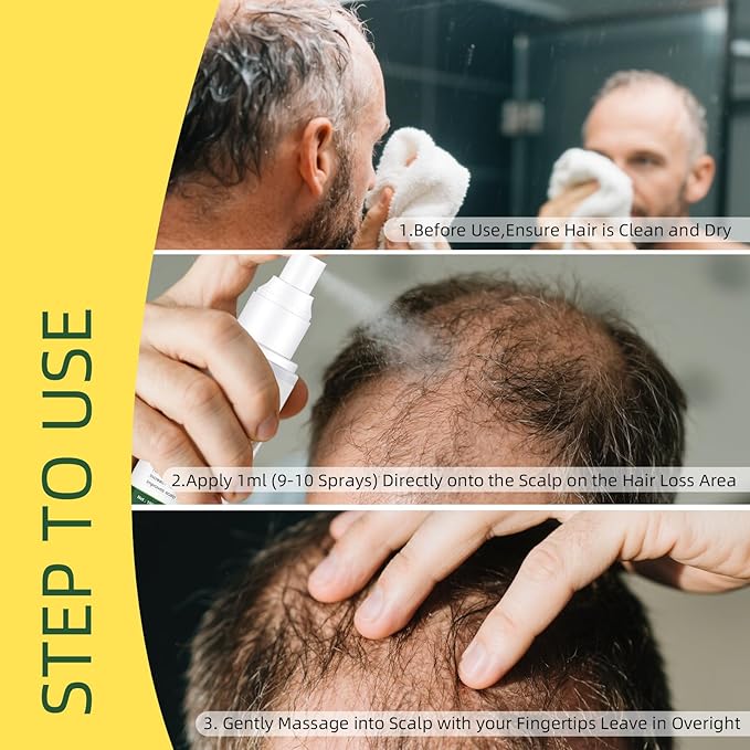 YAFUSIPE Hair Growth Oil Spray Batana Oil Dr Sebi Organic With Rosemary Castor Ginger, Natural Hair Loss Treatments for Women Men Promotes Regrowth Reduces Loss Thinning Strengthen Scalp Nourishes Dry