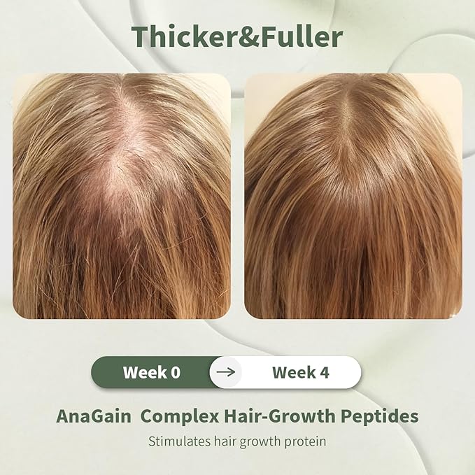 DORPANG Scalp Serum for Thinning Hair, Clinically Tested Vegan Formula with Capixyl and AnaGain, Promotes Fuller-Looking Hair & Healthy Scalp, Peptide Non-Greasy for Dry Sensitive Scalps 60ml