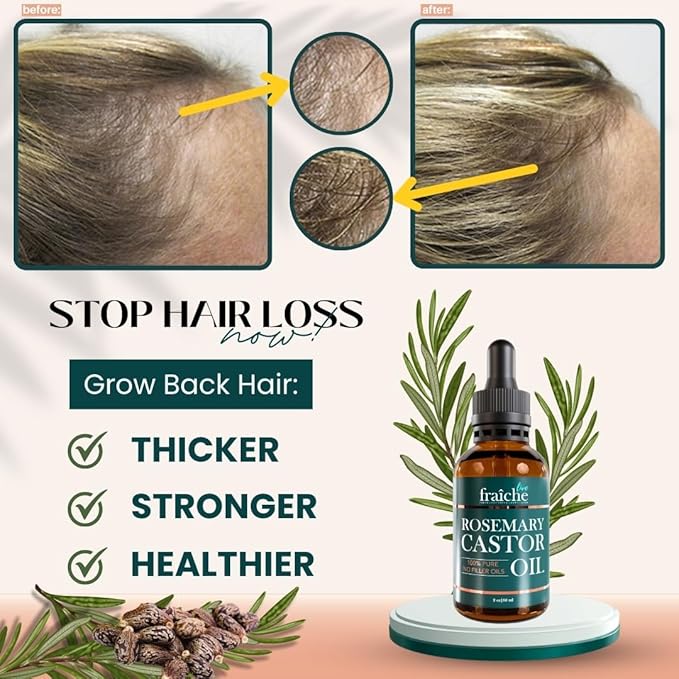 Rosemary Essential Oil For Hair Growth Blend with Castor Oil Scalp Hair Oil