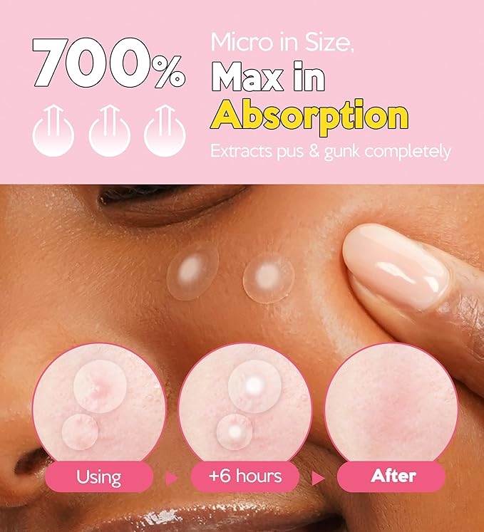 Troubless Invisible Plus Spot Patch - Hydrocolloid (0.8cm & 1cm, 123 EA)